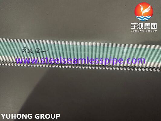 قنية AVF عالية الأداء من الفولاذ المقاوم للصدأ الطبي SUS304 لغسيل الكلى بنطاق مقياس 15G-17G وسطح مصقول بدقة